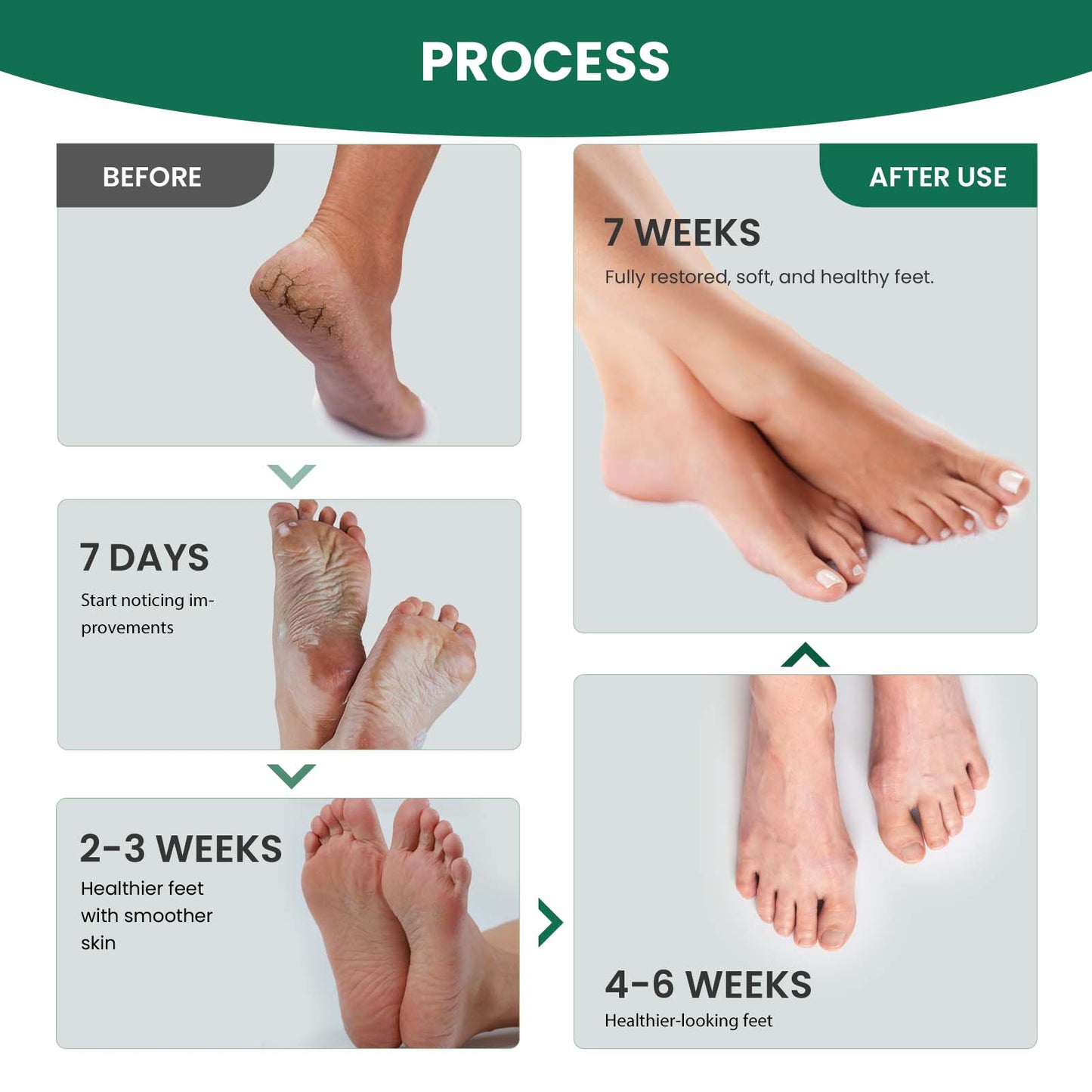 AIFUFAND Natural Athlete's Foot Treatment Spray – Soothes Itching, Burning & Prevents Fungal Infections | Ginger & Tea Tree Oil Formula for Foot Relief | Gentle Antifungal Care for Cracked, Dry Skin & Odor Control (Travel Size-20ML))