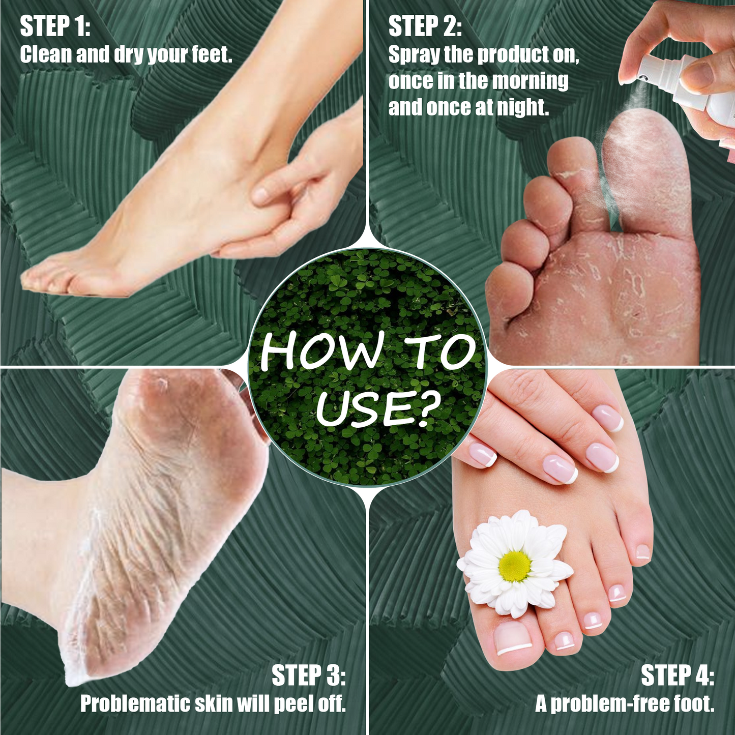 AIFUFAND Natural Athlete's Foot Treatment Spray – Soothes Itching, Burning & Prevents Fungal Infections | Ginger & Tea Tree Oil Formula for Foot Relief | Gentle Antifungal Care for Cracked, Dry Skin & Odor Control (Travel Size-20ML))