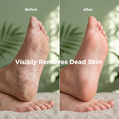 Before and after smoother-looking feet with AIFUFAND foot care spray