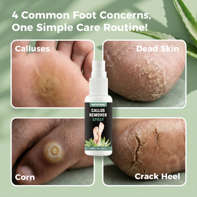 AIFUFAND foot care spray for common rough dry foot concerns