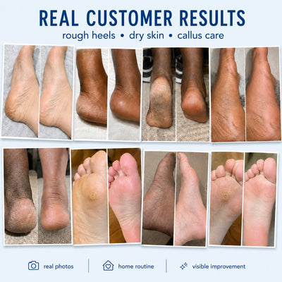AIFUFAND real customer foot care results collage