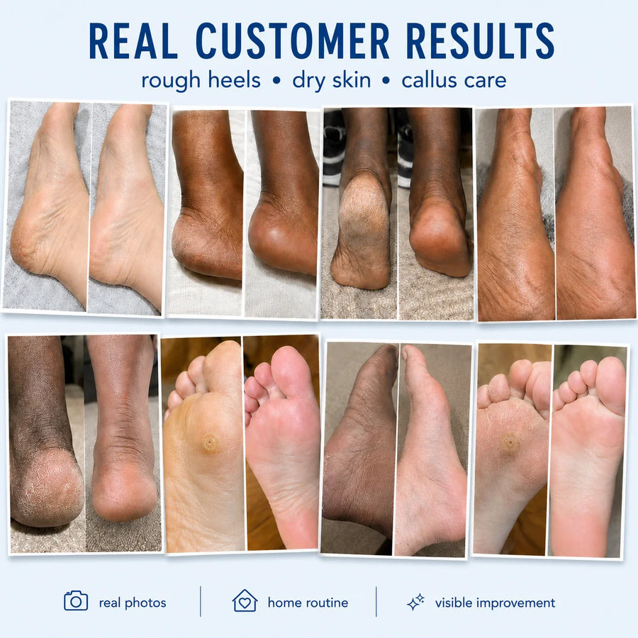 AIFUFAND real customer foot care results collage