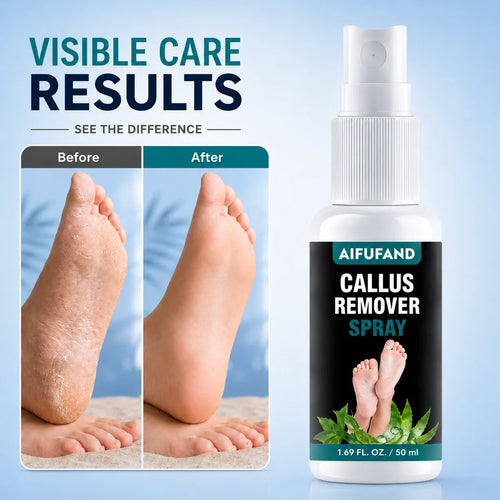 AIFUFAND Callus Remover Spray