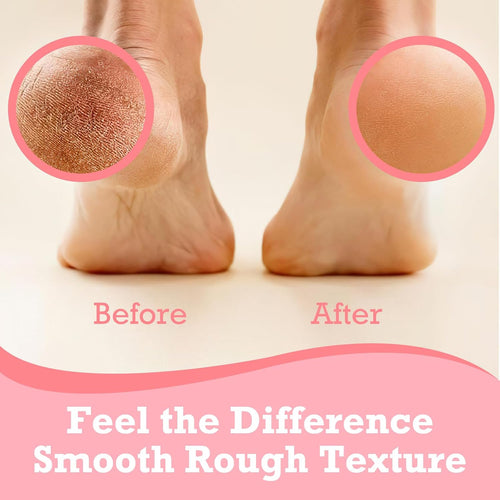 Before and after foot-care image